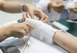 Assistência De Enfermagem Ao Paciente Queimado